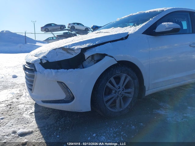 KMHD84LF1JU577546 Hyundai ELANTRA GL