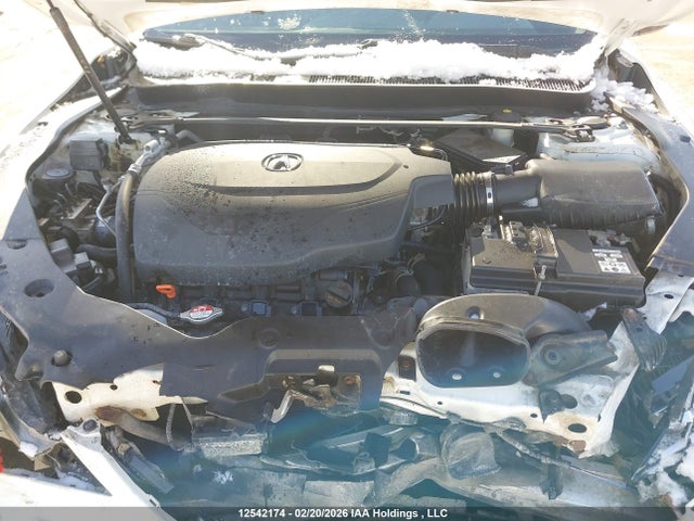 Acura Tlx Elite 2015 19UUB3F75FA804123 Image 10
