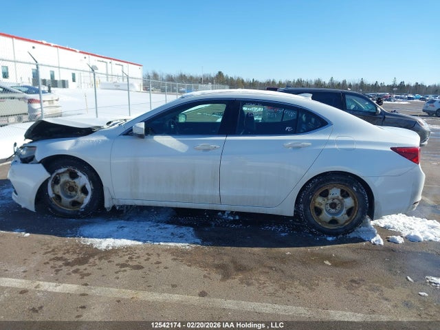 Acura Tlx Elite 2015 19UUB3F75FA804123 Image 14