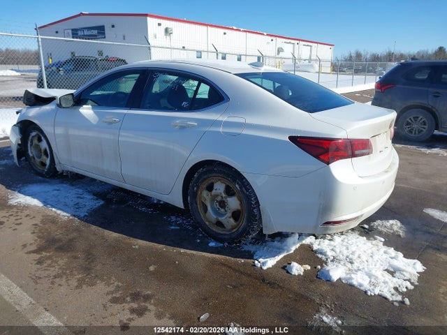 Acura Tlx Elite 2015 19UUB3F75FA804123 Image 3