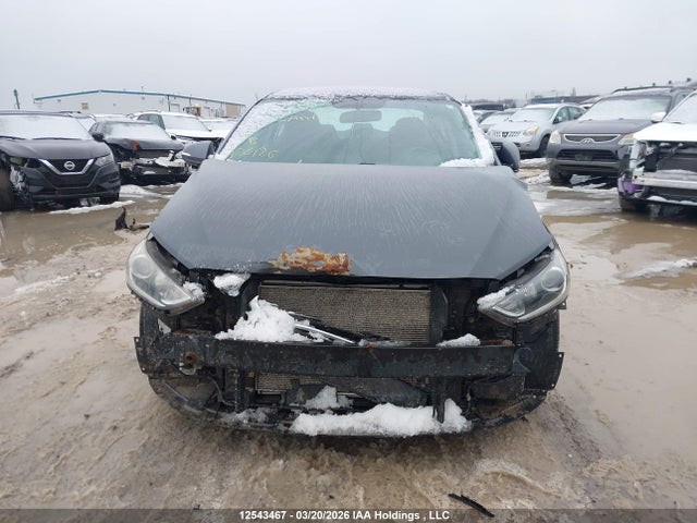 KMHD84LF1JU715327 Hyundai ELANTRA GL