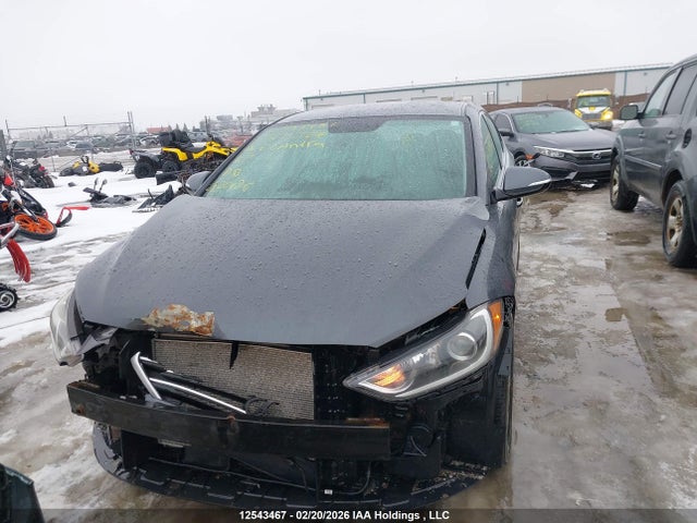 KMHD84LF1JU715327 Hyundai ELANTRA GL