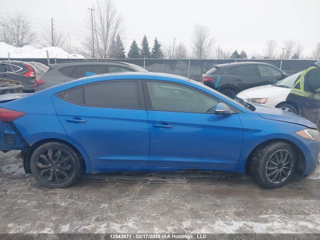 KMHD84LF9HU323304 Hyundai Elantra