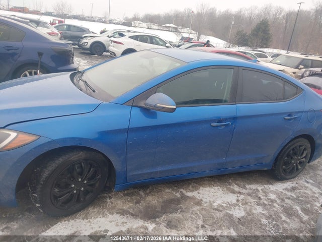 KMHD84LF9HU323304 Hyundai Elantra