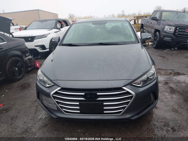 KMHD84LF1JU661320 Hyundai ELANTRA GL