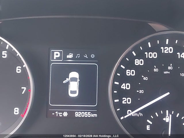 KMHD84LF1JU661320 Hyundai ELANTRA GL