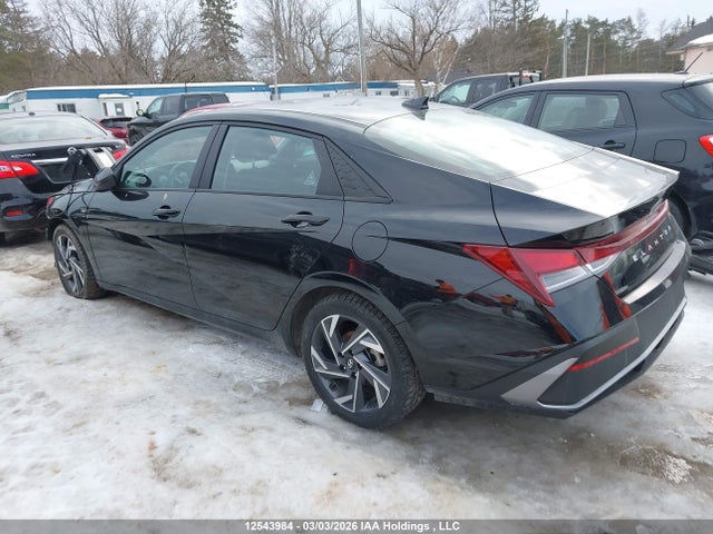 KMHLM4DG7RU757415 Hyundai ELANTRA SEL