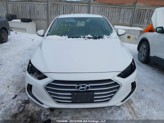 KMHD84LF3HU276044 Hyundai ELANTRA GL