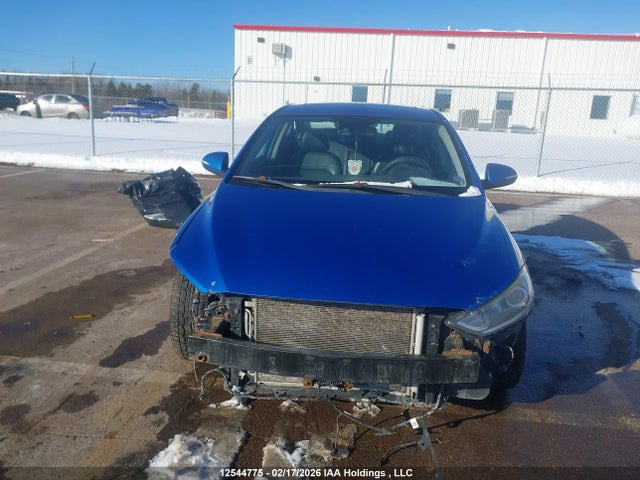 KMHD84LF2JU540943 Hyundai Elantra Gls