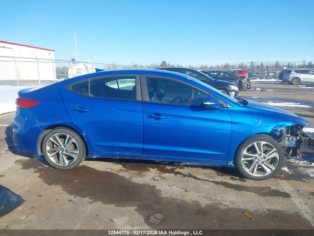 KMHD84LF2JU540943 Hyundai Elantra Gls