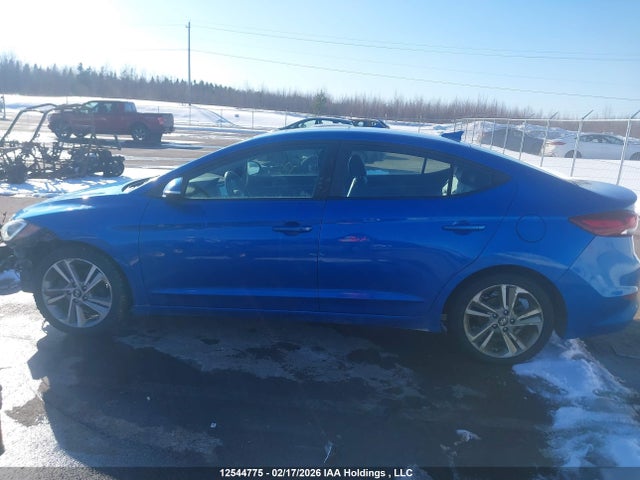 KMHD84LF2JU540943 Hyundai Elantra Gls