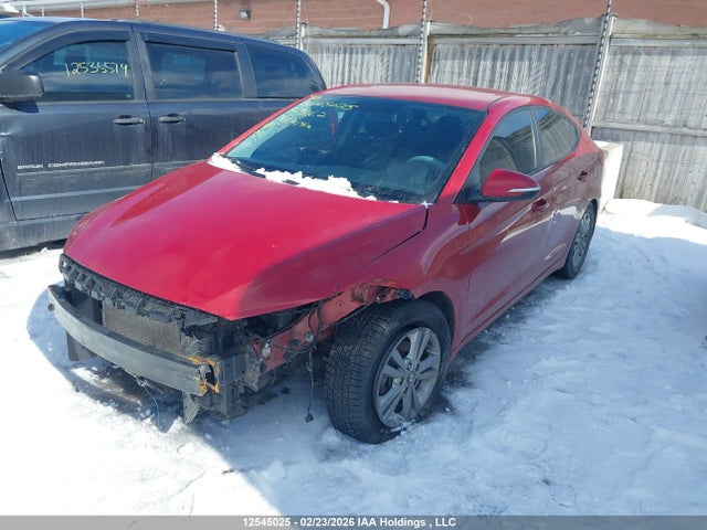 KMHD84LF4JU509662 Hyundai ELANTRA GL