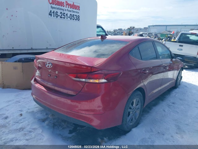 KMHD84LF4JU509662 Hyundai ELANTRA GL