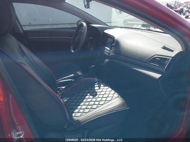 KMHD84LF4JU509662 Hyundai ELANTRA GL