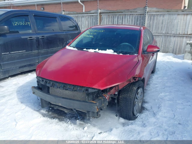 KMHD84LF4JU509662 Hyundai ELANTRA GL