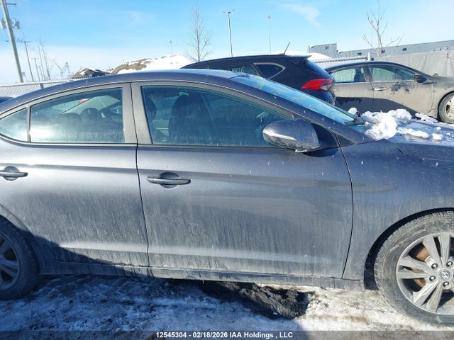 KMHD84LFXHU121376 Hyundai ELANTRA GL