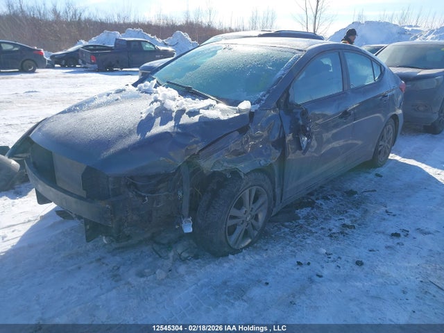 KMHD84LFXHU121376 Hyundai ELANTRA GL
