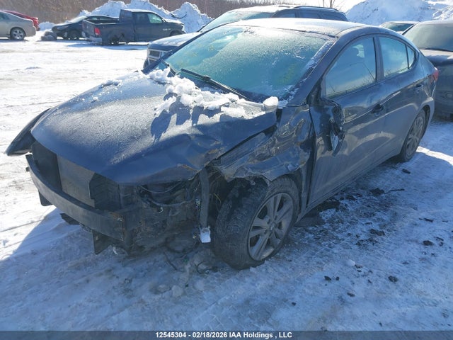 KMHD84LFXHU121376 Hyundai ELANTRA GL