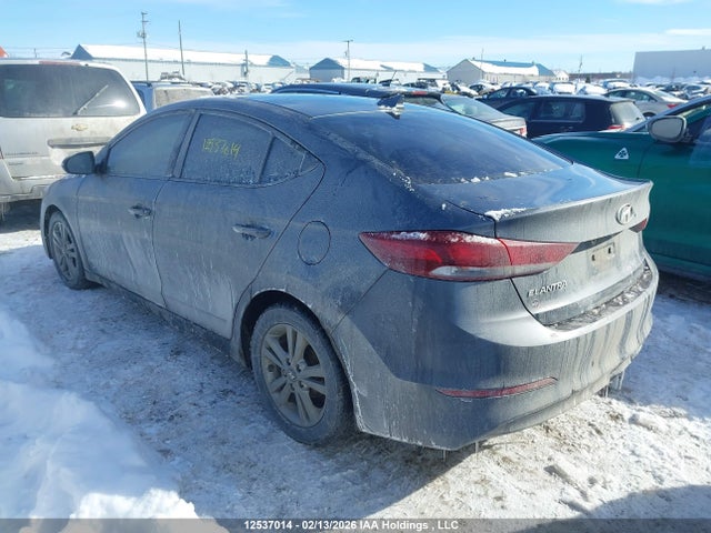 KMHD84LF9JU636939 Hyundai ELANTRA GL