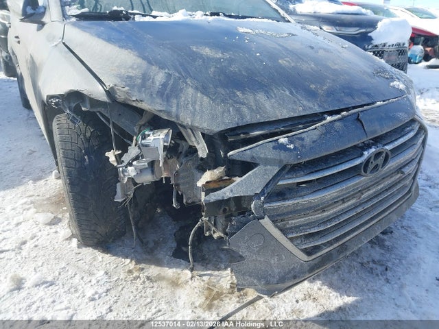 KMHD84LF9JU636939 Hyundai ELANTRA GL