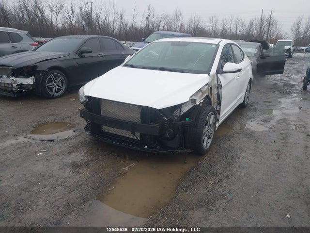 KMHD84LFXHU130949 Hyundai Elantra Gls