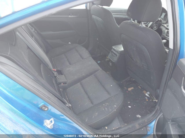 KMHD84LF1HU243673 Hyundai ELANTRA GL