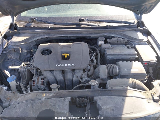 KMHD84LF0HU399557 Hyundai ELANTRA GL