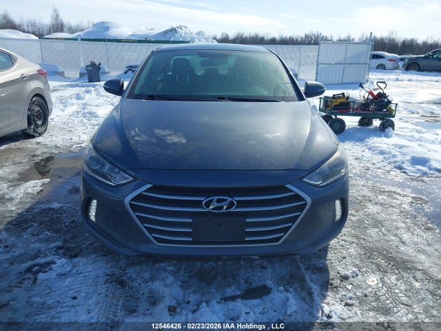 KMHD84LF0HU399557 Hyundai ELANTRA GL
