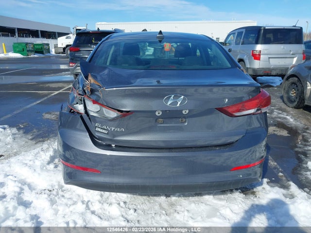 KMHD84LF0HU399557 Hyundai ELANTRA GL