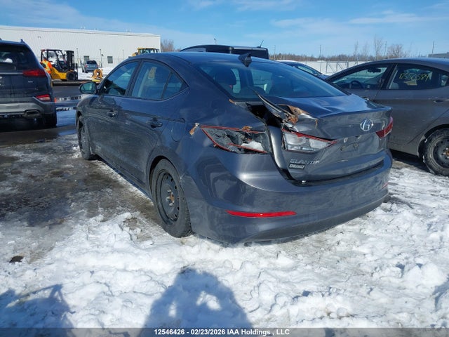 KMHD84LF0HU399557 Hyundai ELANTRA GL