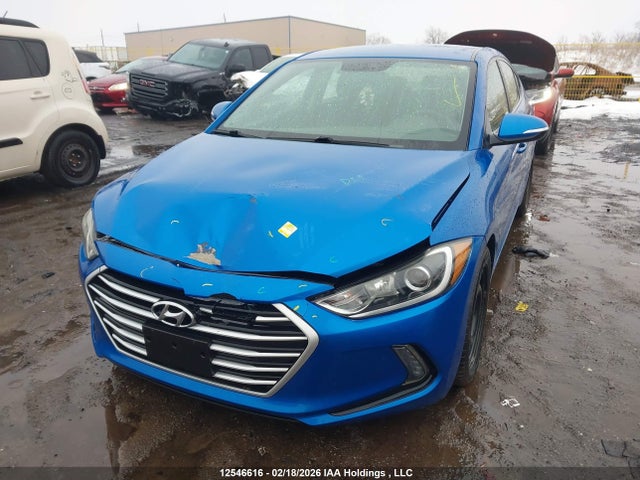 KMHD84LF7JU596358 Hyundai ELANTRA GL
