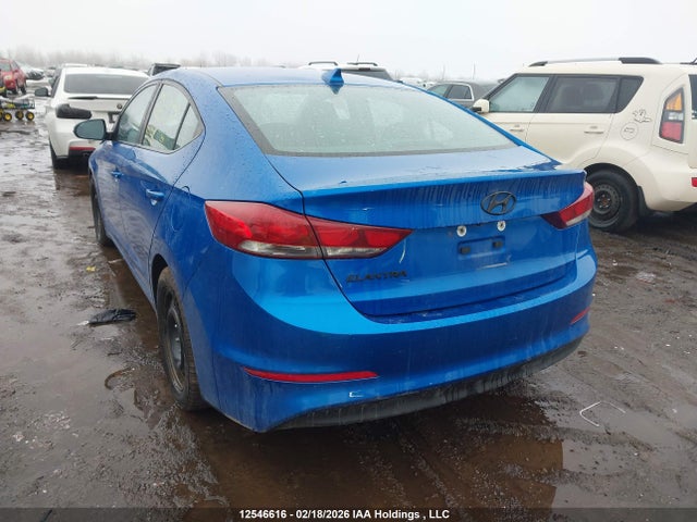 KMHD84LF7JU596358 Hyundai ELANTRA GL