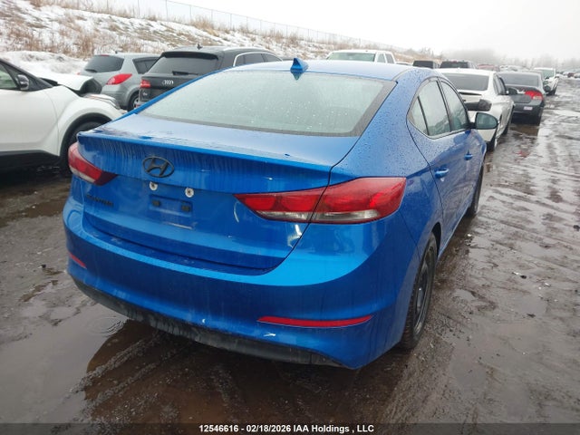 KMHD84LF7JU596358 Hyundai ELANTRA GL