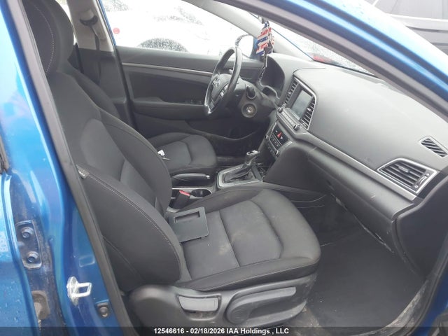 KMHD84LF7JU596358 Hyundai ELANTRA GL