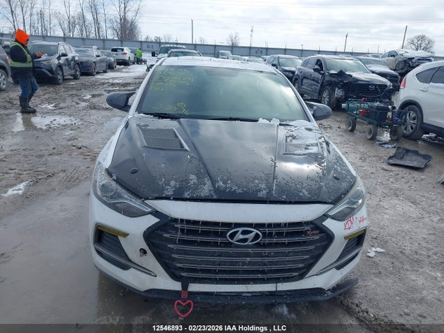 KMHD04LB1JU548715 Hyundai Elantra Sport