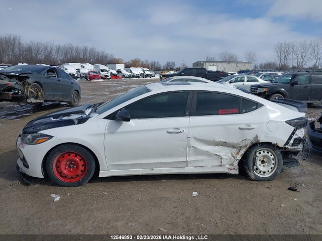 KMHD04LB1JU548715 Hyundai Elantra Sport