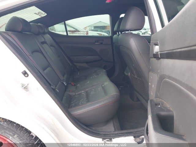 KMHD04LB1JU548715 Hyundai Elantra Sport