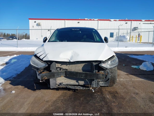 KMHD84LFXHU140560 Hyundai Elantra Se/value/limited