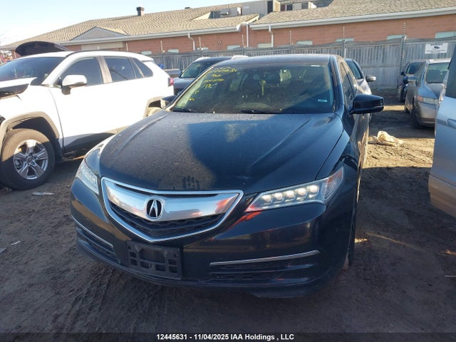 Acura TLX TECH 2015 19UUB3F58FA800856 Image 12