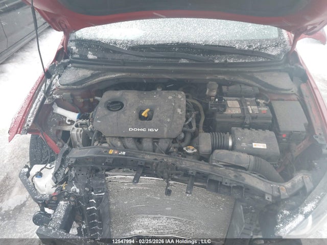 KMHD84LF6HU104591 Hyundai Elantra Limited