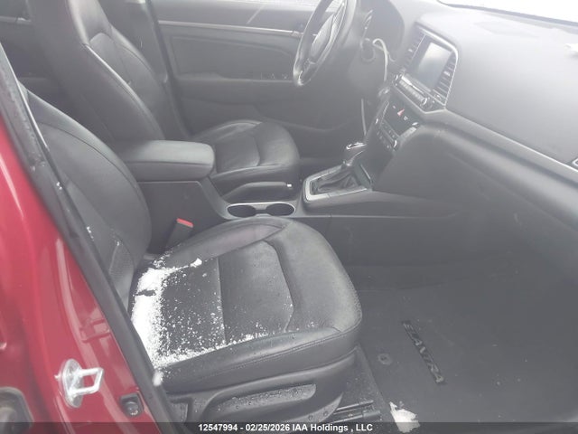 KMHD84LF6HU104591 Hyundai Elantra Limited