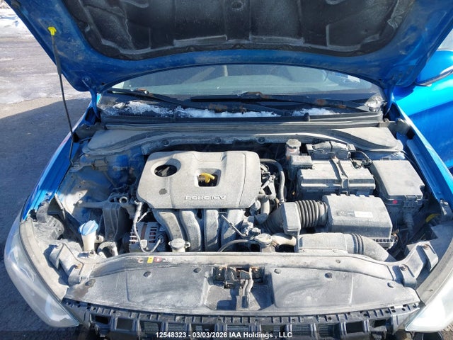 KMHD84LF5HU185681 Hyundai ELANTRA GL