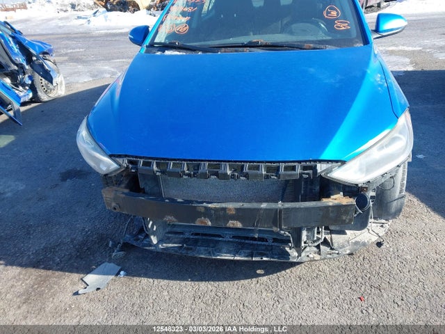 KMHD84LF5HU185681 Hyundai ELANTRA GL