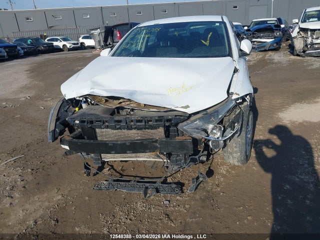 12548388 :رقم المزاد ، 5NPD74LF5HH182796 vin ، 2017 Hyundai Elantra Se مزاد بيع
