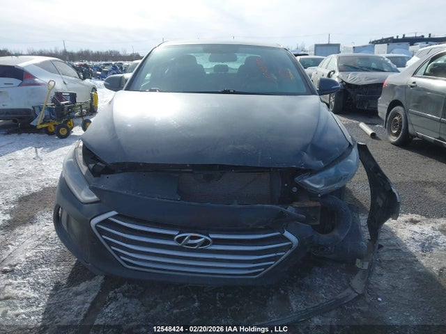 KMHD84LF2HU158051 Hyundai Elantra