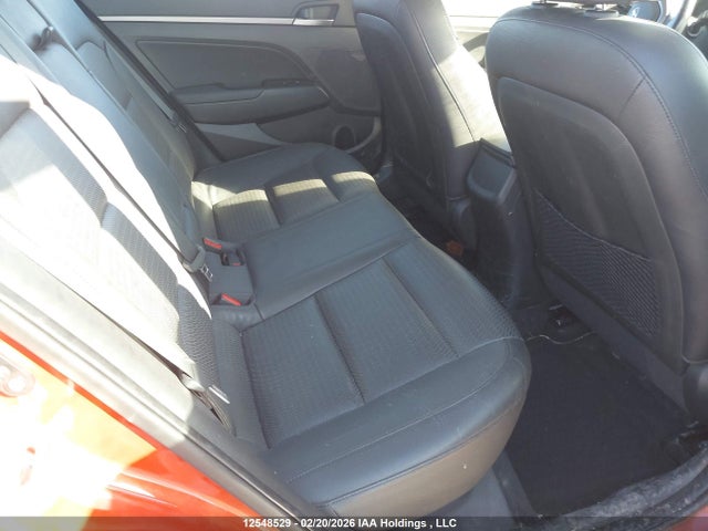 KMHD84LF9HU293690 Hyundai ELANTRA SE