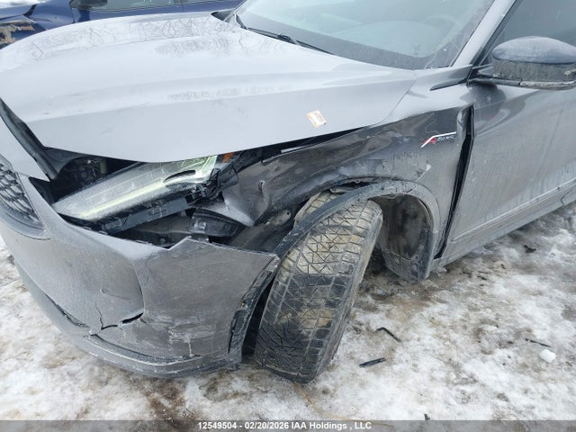 Acura MDX A-SPEC 2022 5J8YE1H01NL804166 Image 6