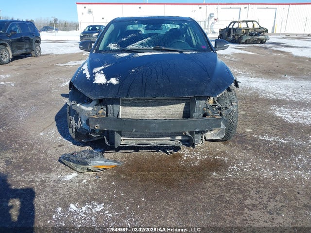 KMHD84LF4HU144278 Hyundai Elantra Gls