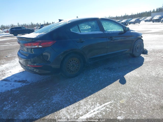 KMHD84LF4HU144278 Hyundai Elantra Gls