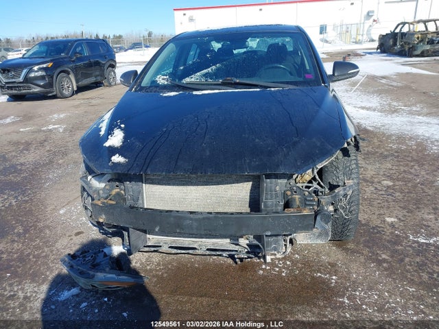 KMHD84LF4HU144278 Hyundai Elantra Gls